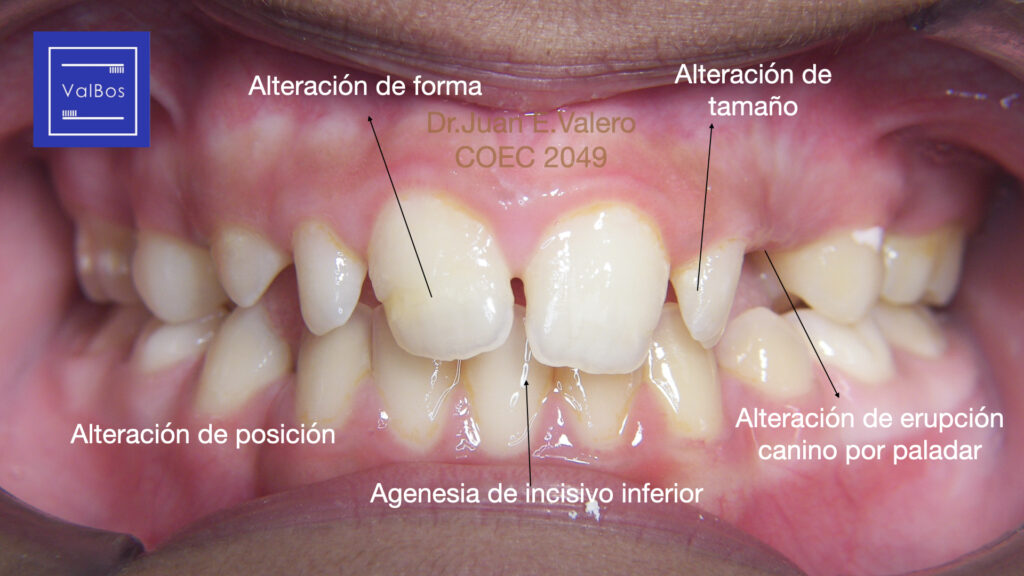 alteraciones dentales