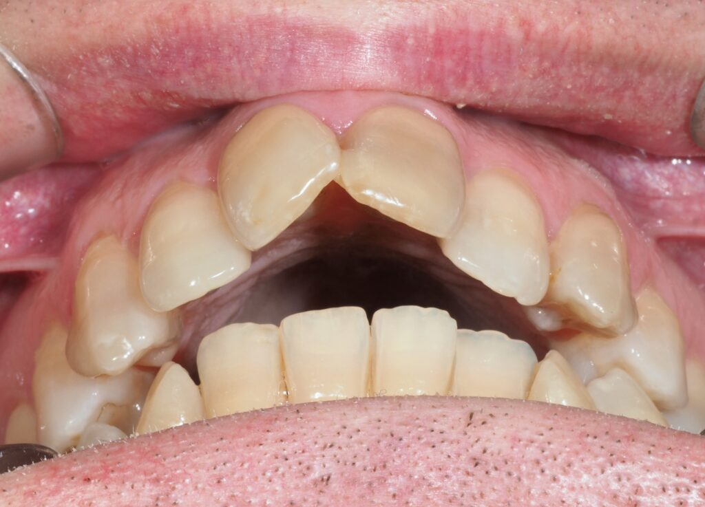 no me gustan mis dientes