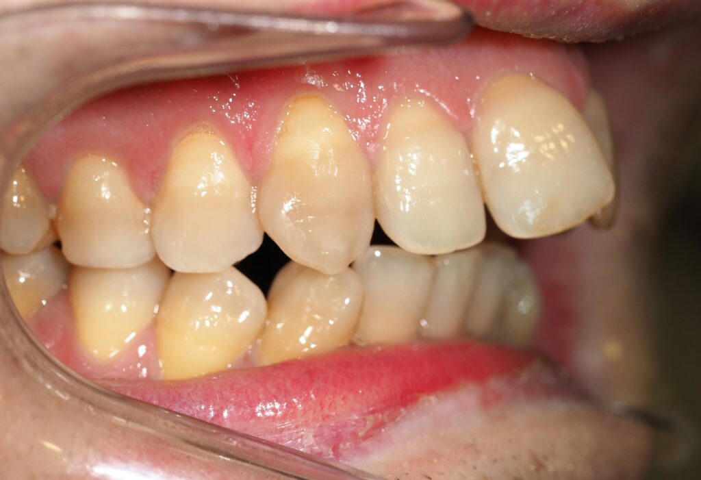 no me gustan mis dientes