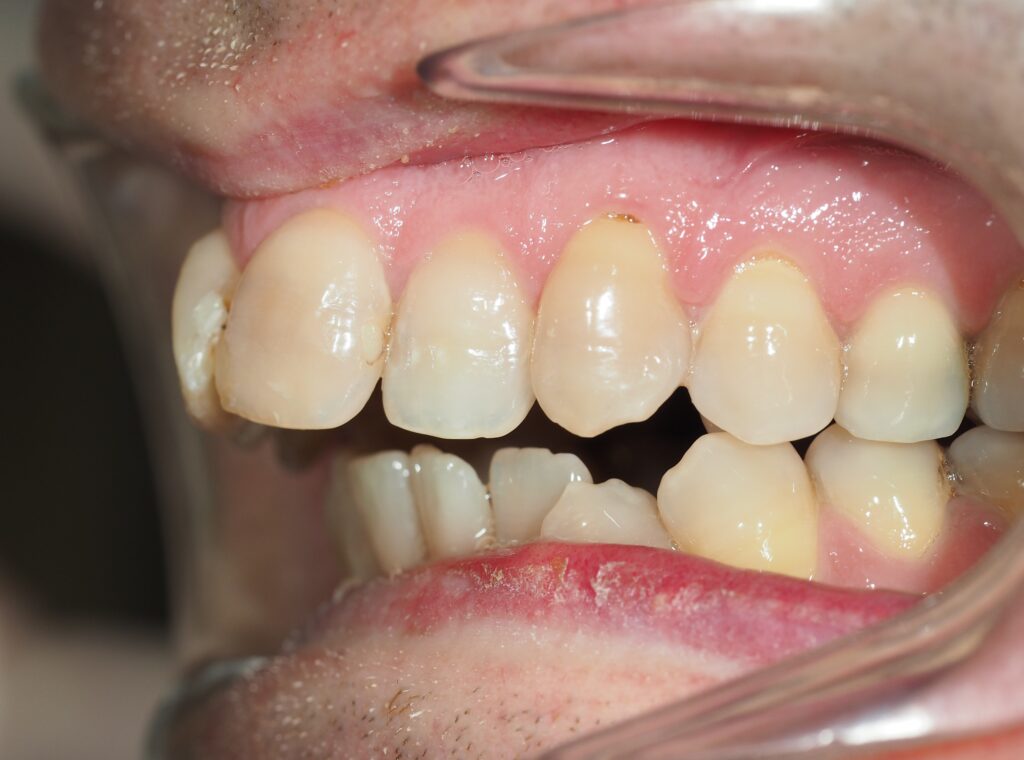 no me gustan mis dientes